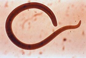 worm